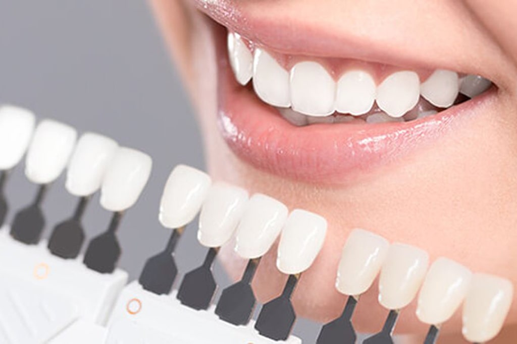 セラミックとは？セラミック治療を歯科医がおすすめする理由