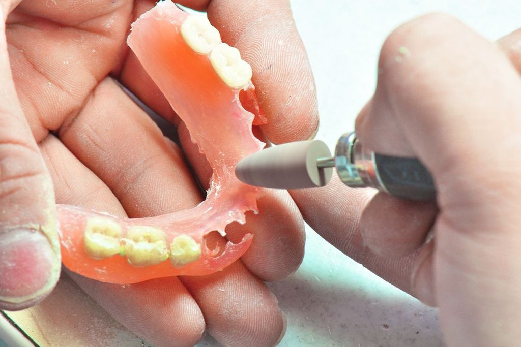 技工所との綿密な連携