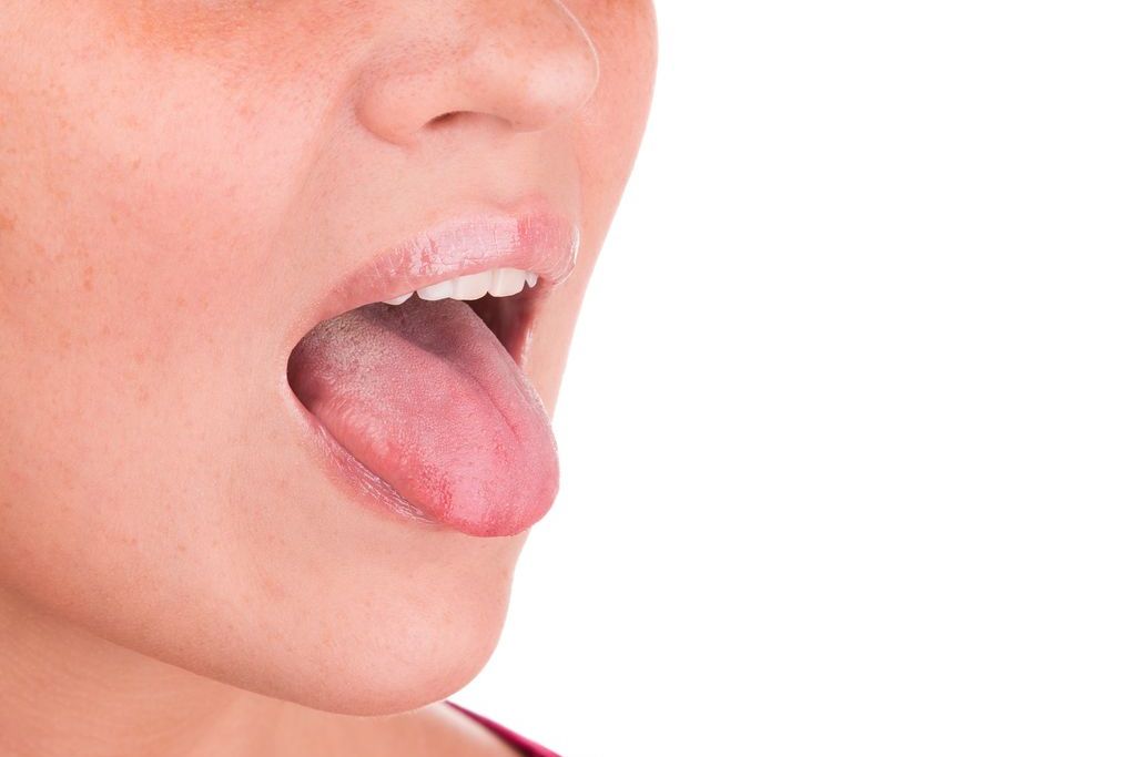 舌の症状と病気