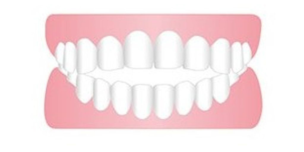 口がポカンと開いている（開咬・オープンバイト）