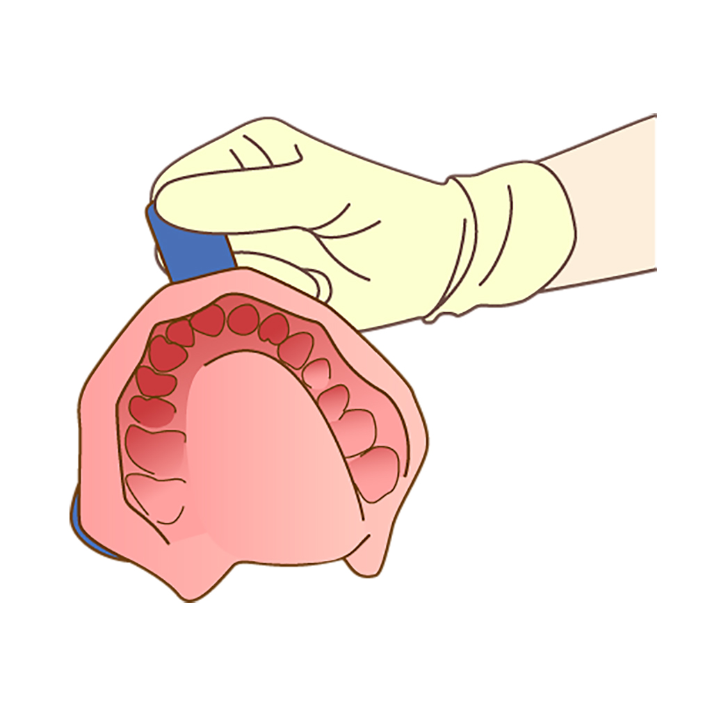 歯科医院で型取り