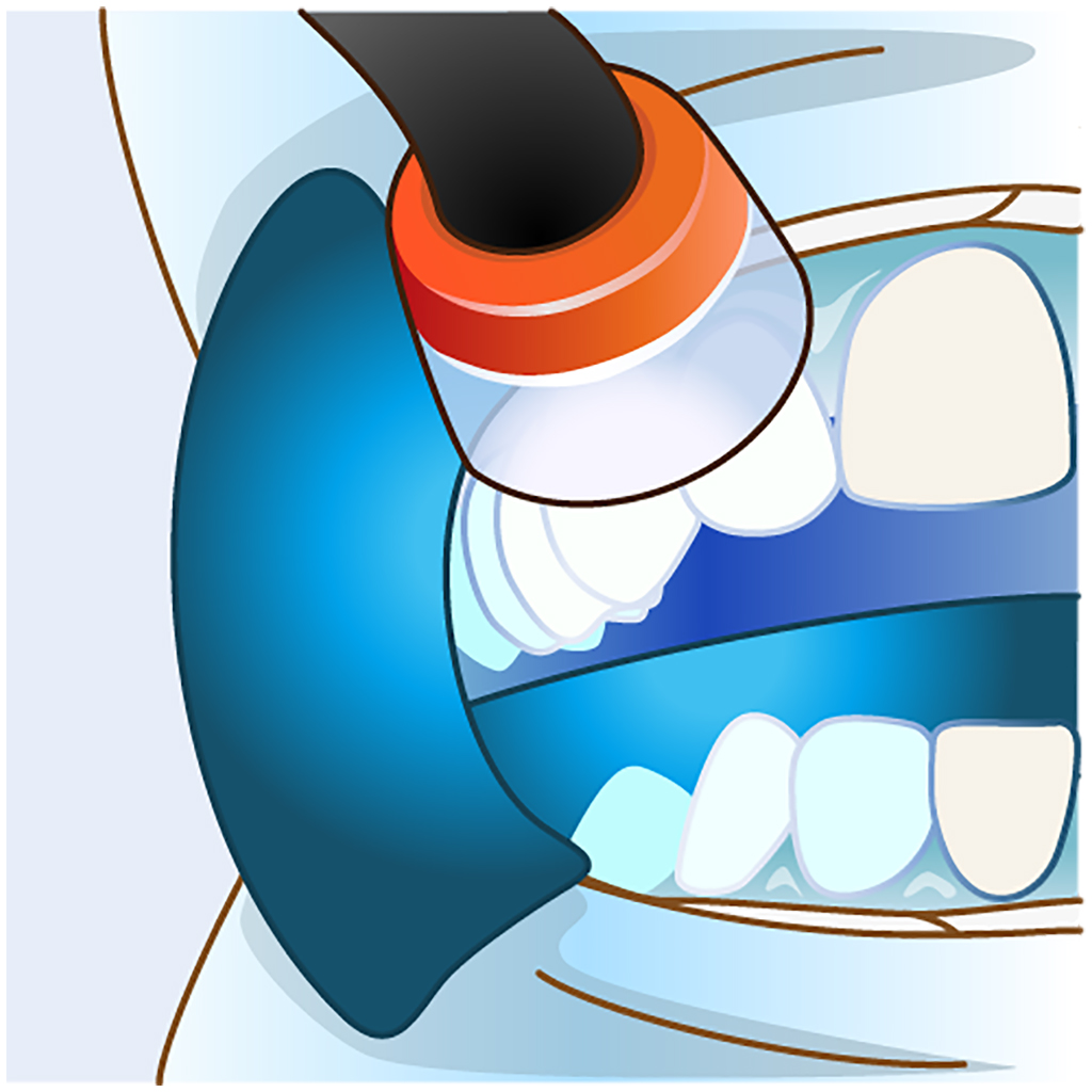 光やレーザーを当てる